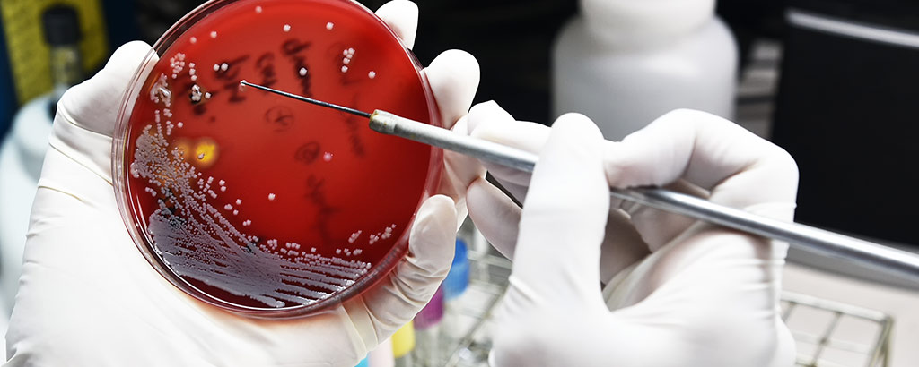 Colistin Resistance on the Rise