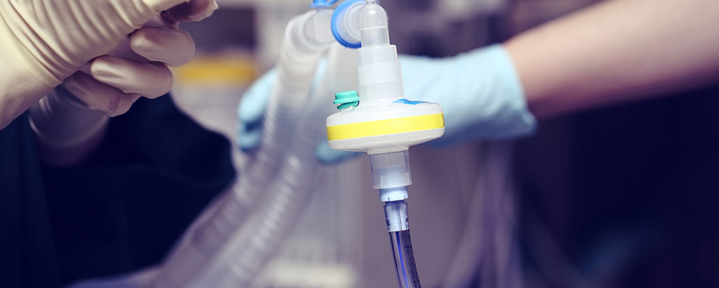 N8 Medical Announces Compelling Publication Supporting Its Breakthrough CeraShield™ Endotracheal Tube
