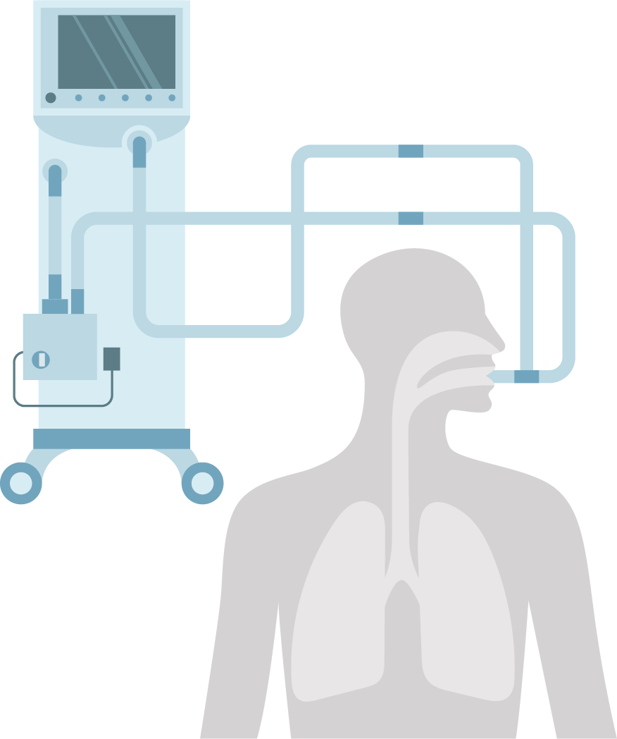 VentilatorGraphic